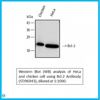 Anti-Bcl-2 antibody[STJ96943]