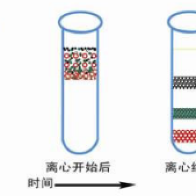 膜蛋白的提取方法，最全攻略在此