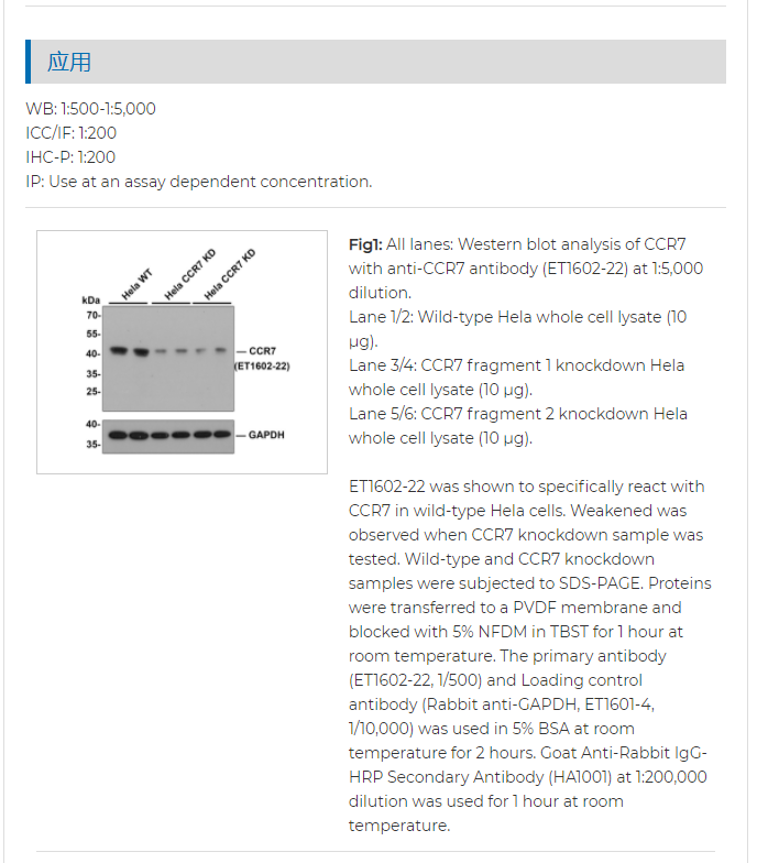 Anti-CCR7 Recombinant Rabbit Monoclonal Antibody [SR36-04](图1)