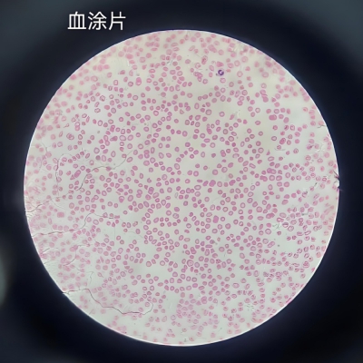 <strong>骨髓涂片制片与阅片分析技术：标准化操作与</strong>