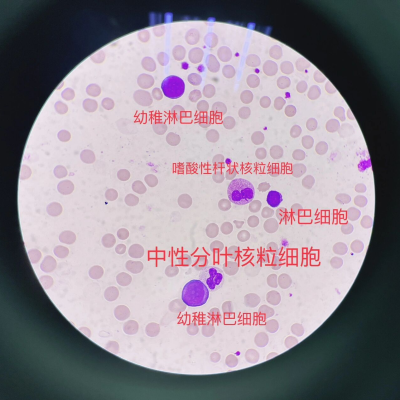 提供骨髓涂片制片/阅片分析技术服务