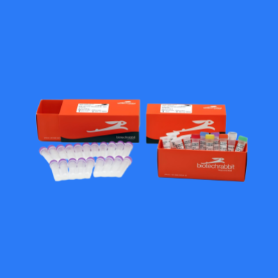 BR1401501/BR1401502/RTS 100 Insect Membrane Kit 昆虫细胞膜蛋白表达试剂盒